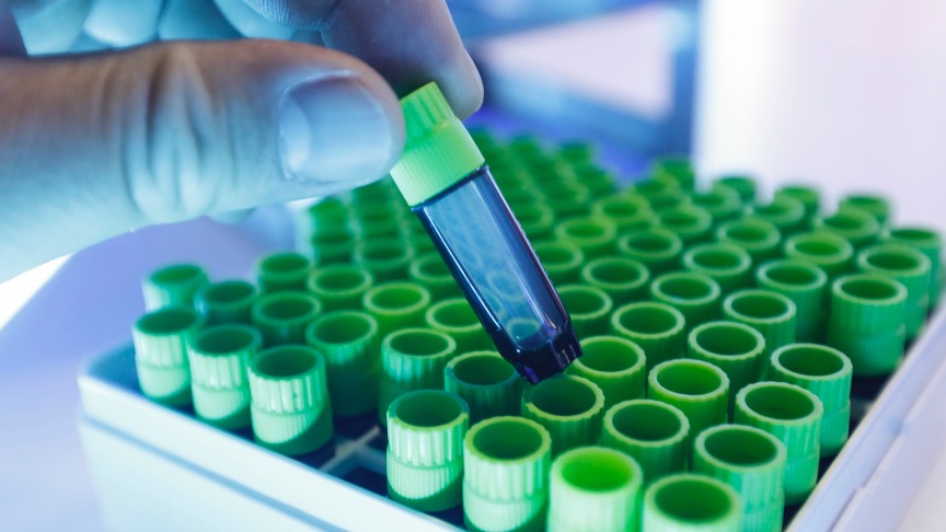 多家上市公司回应“万能神药”,有产品紧急下架!国内已注册数百个临床试验