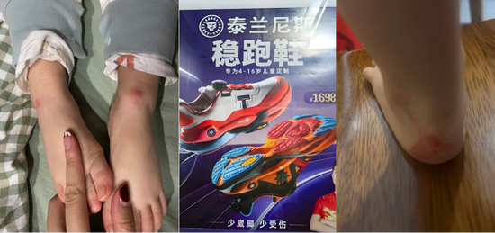 千元童鞋把脚穿肿?泰兰尼斯遭家长“围攻”,医生警惕影响发育,90%专利竟是外观设计
